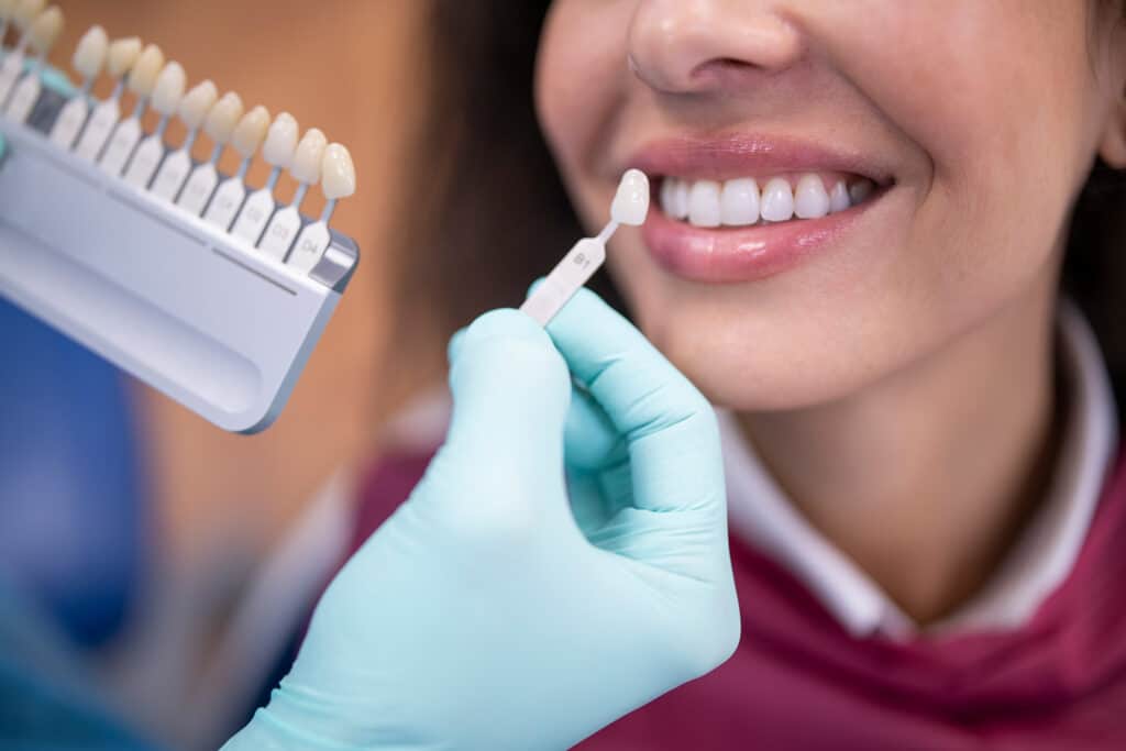 GW Students' Most Common Dental Issues and How to Prevent Them