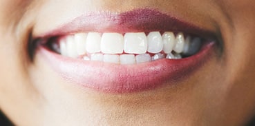 Cosmetic Bonding in Foggy Bottom - Blossom Dentistry