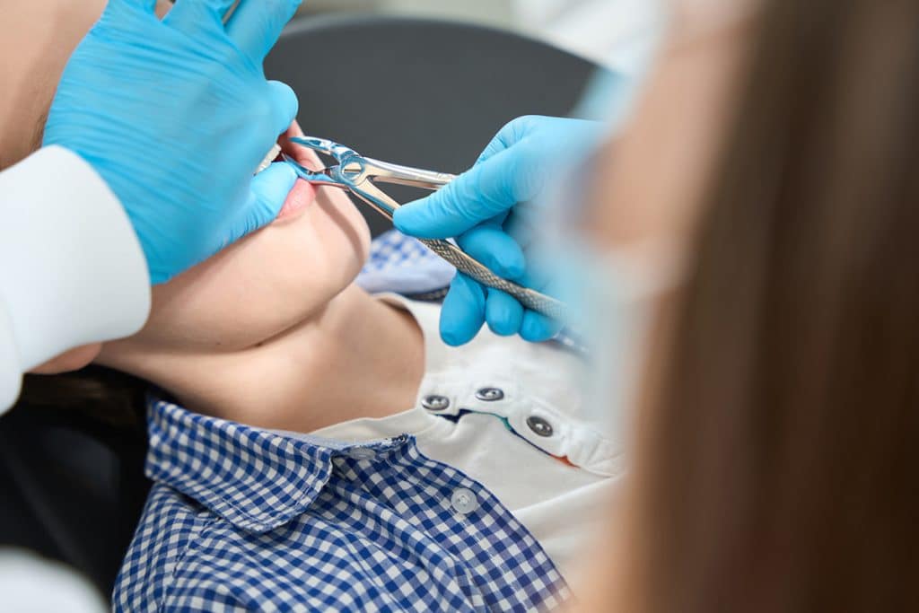 What to Eat or Avoid After Dental Extractions